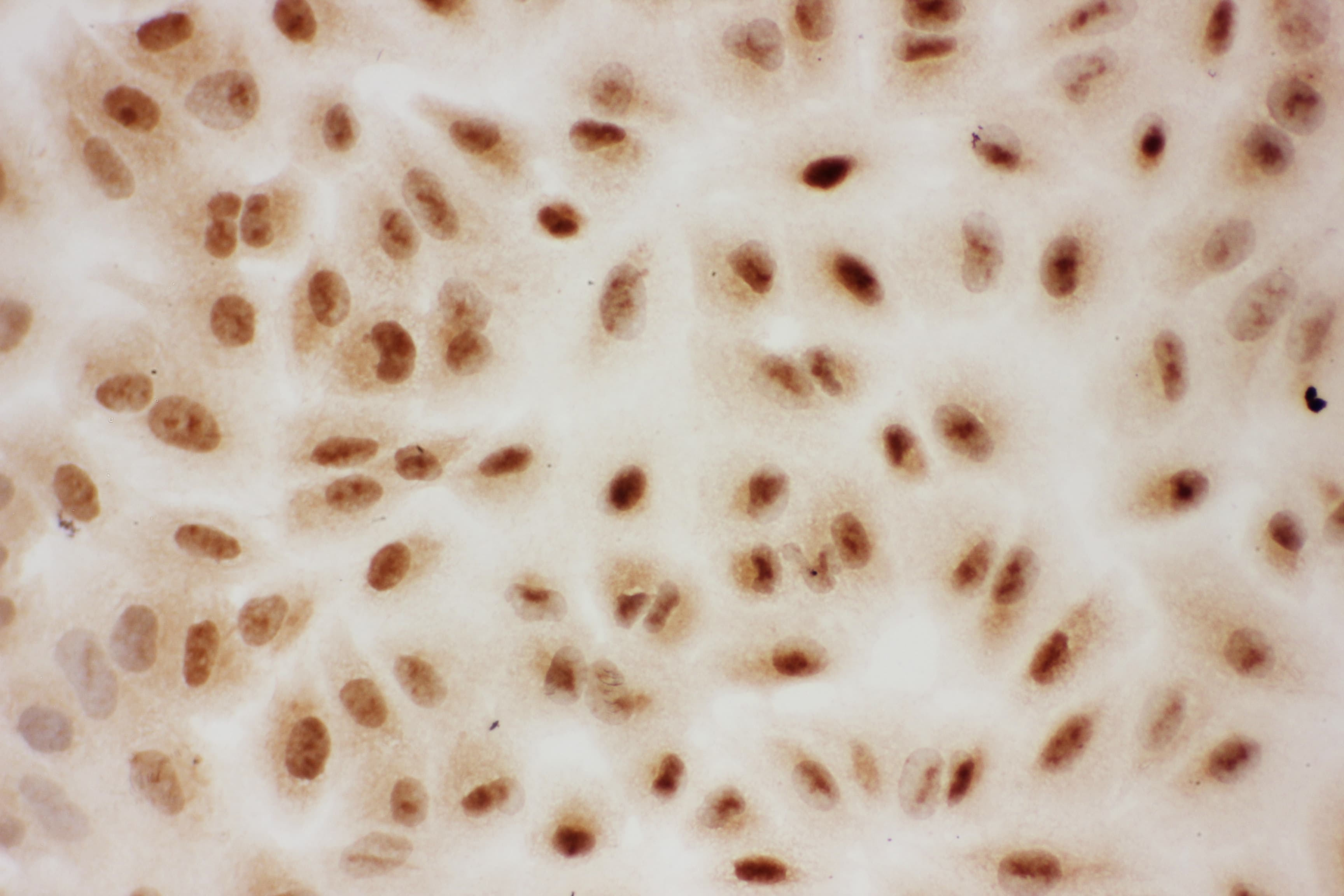 PIAS1 Antibody (aa636-651)