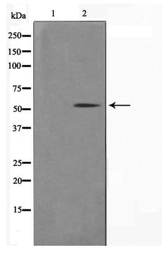 KRT14 / CK14 / Cytokeratin 14 Antibody