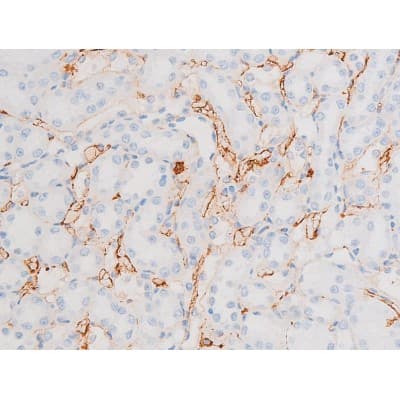 Polyclonal Rabbit anti-Human DNM1 / Dynamin Antibody (phospho-Ser774, IHC, WB)