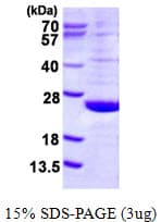 Human DUSP21 Protein (Recombinant His)