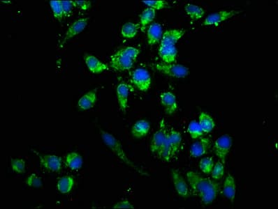 UBE2K / LIG Antibody