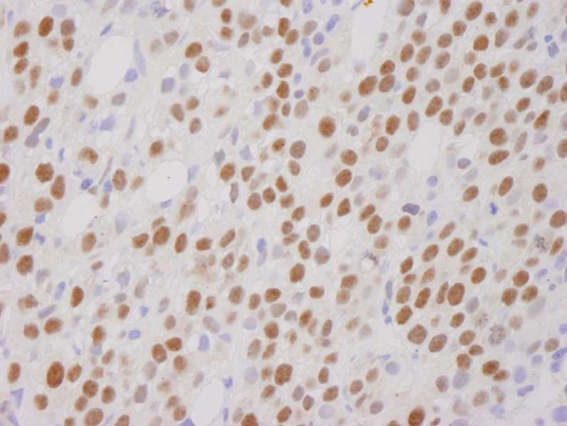 IHC-plus™ RCOR1 / COREST Antibody (aa425-C-term)