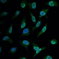 BCL2 / Bcl-2 Antibody