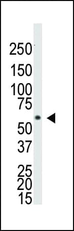 Polyclonal Rabbit anti-Human ALK3 / BMPR1A Antibody (aa30-60, IHC, WB)