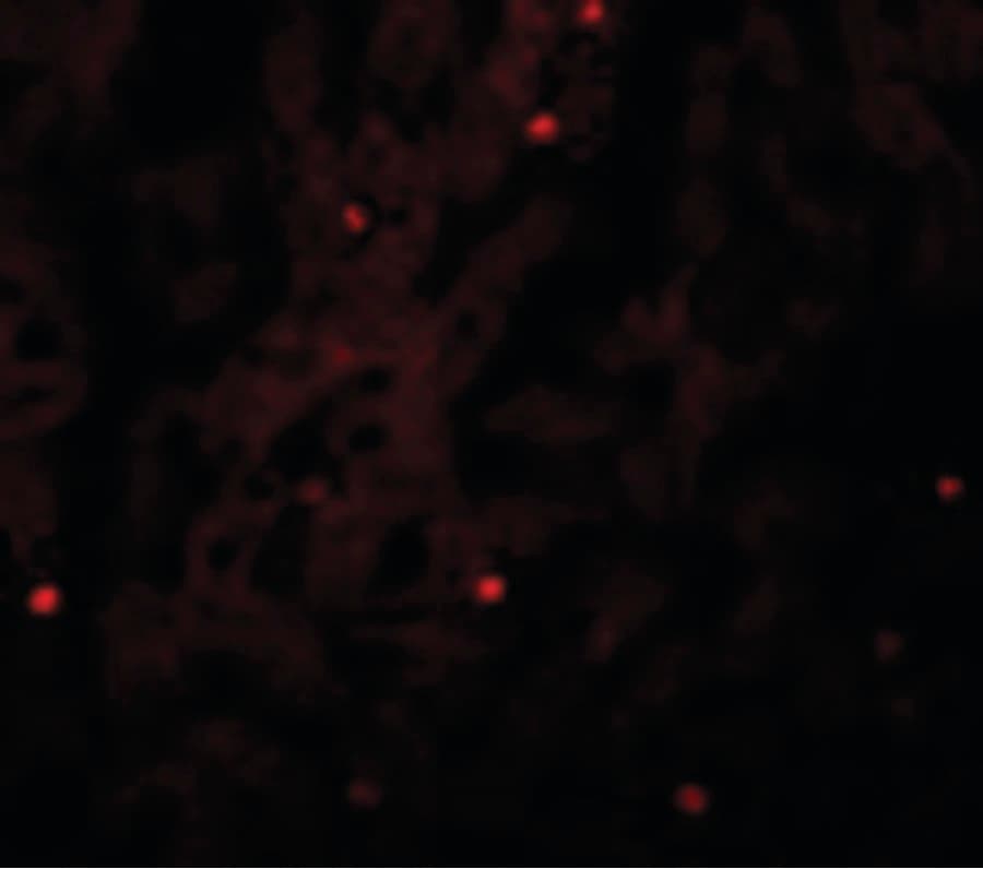 IHC-plus™ GAREM / FAM59A Antibody