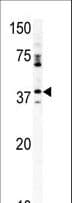 Polyclonal Rabbit anti-Human CDK20 / CCRK Antibody (aa16-45, WB)