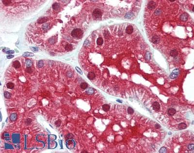 IHC-plus™ FAH Antibody