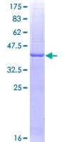 Human JTB / PAR Protein (Recombinant GST)