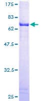Human ALDH3B2 Protein (Recombinant GST)