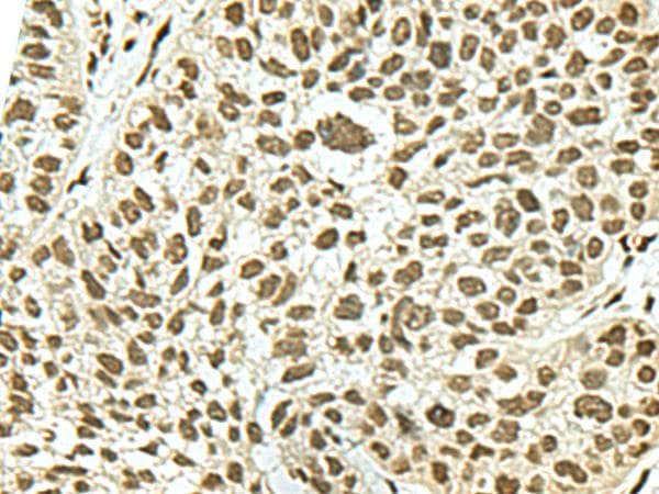 Polyclonal Rabbit anti-Human KHSRP / FBP2 Antibody (IHC, WB)