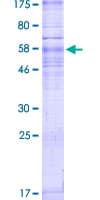 Human SIPR3 / EDG3 / S1P3 Protein (Recombinant GST)