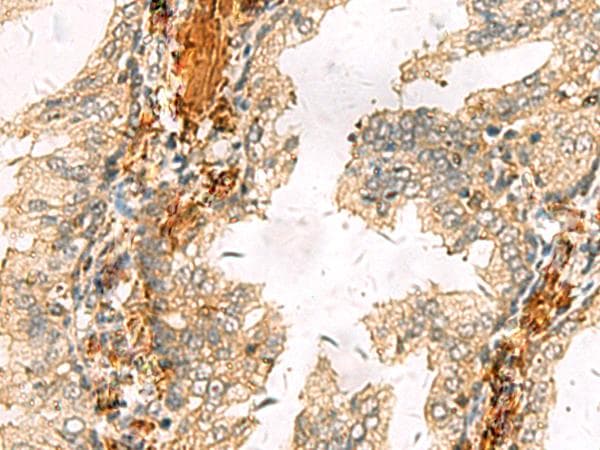 ACTC1 / Alpha Cardiac Actin Antibody