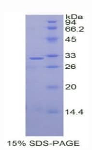Human DKK1 Protein (Recombinant His)