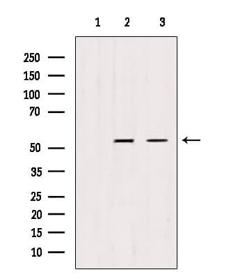 TRIM44 Antibody
