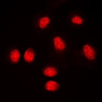 AML1 / RUNX1 Antibody (Internal)