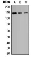 Polyclonal Rabbit anti-Human ADAMTS18 Antibody (C-Terminus, WB)