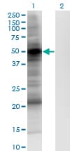 Monoclonal Mouse anti-Human PDPK1 / PDK1 Antibody (clone 2E2, WB)