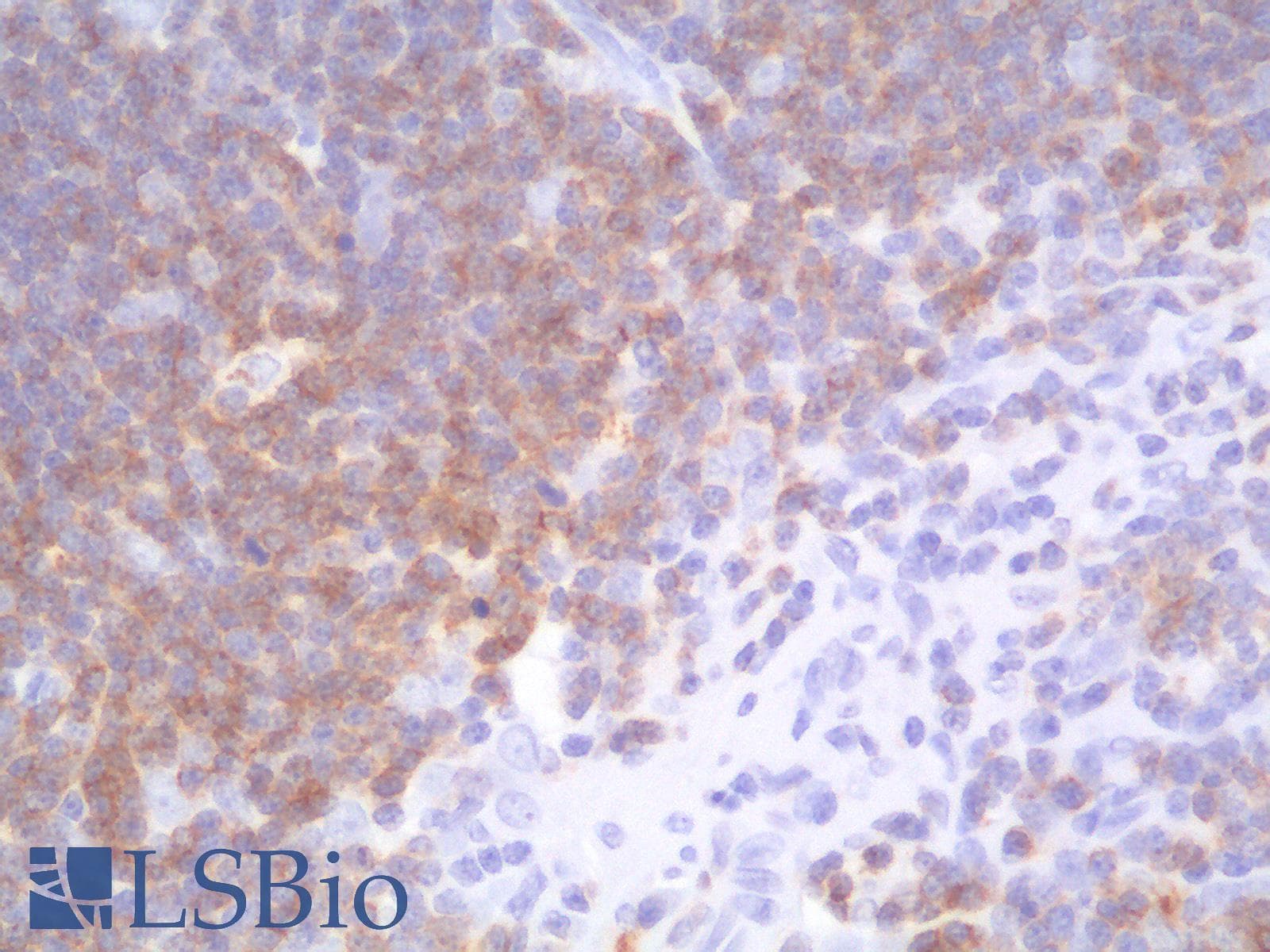 PathPlus™ CD1A Antibody (clone C1A/1506R)
