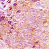 Polyclonal Rabbit anti-Human CAMKK2 Antibody (Internal, IHC, WB)