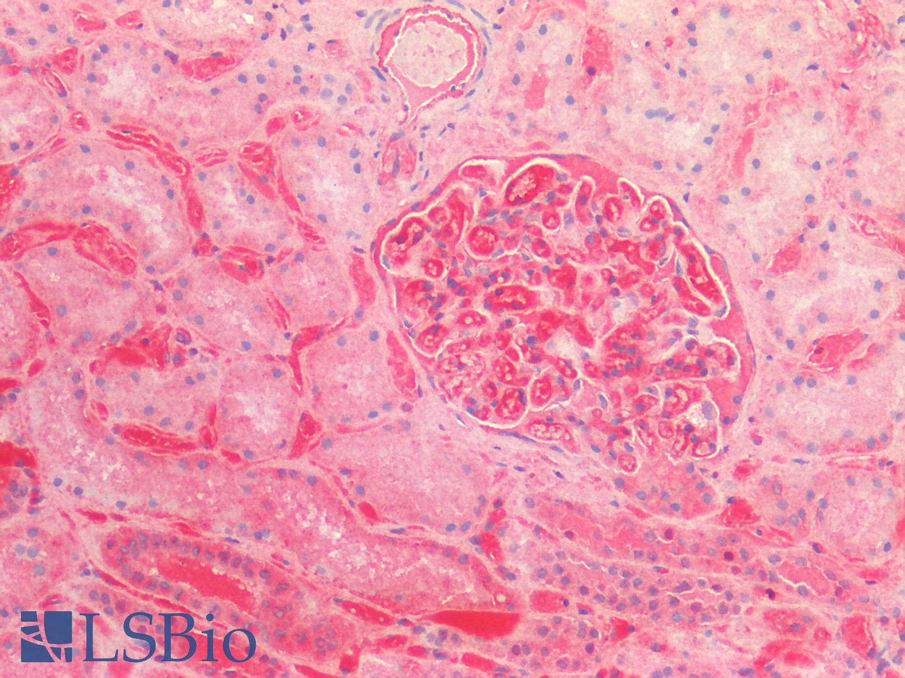 IHC-plus™ Monoclonal Mouse anti-Human FN1 / Fibronectin Antibody (IHC, IF, WB)