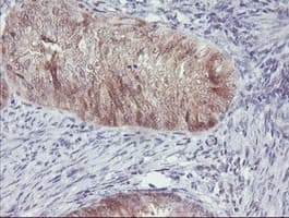 ACY1 / Aminoacylase 1 Antibody (clone OTI2F1)