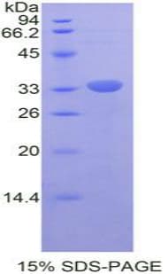 Mouse RELB Protein (Recombinant His-T7)