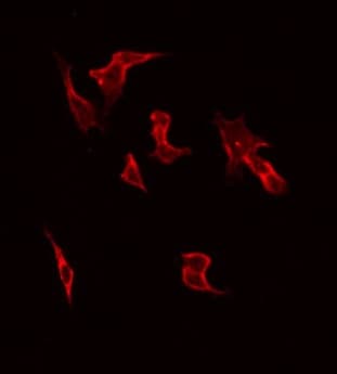 CTTN / Cortactin Antibody