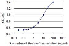 PREP / Prolyl Endopeptidase Antibody (clone 2D7)