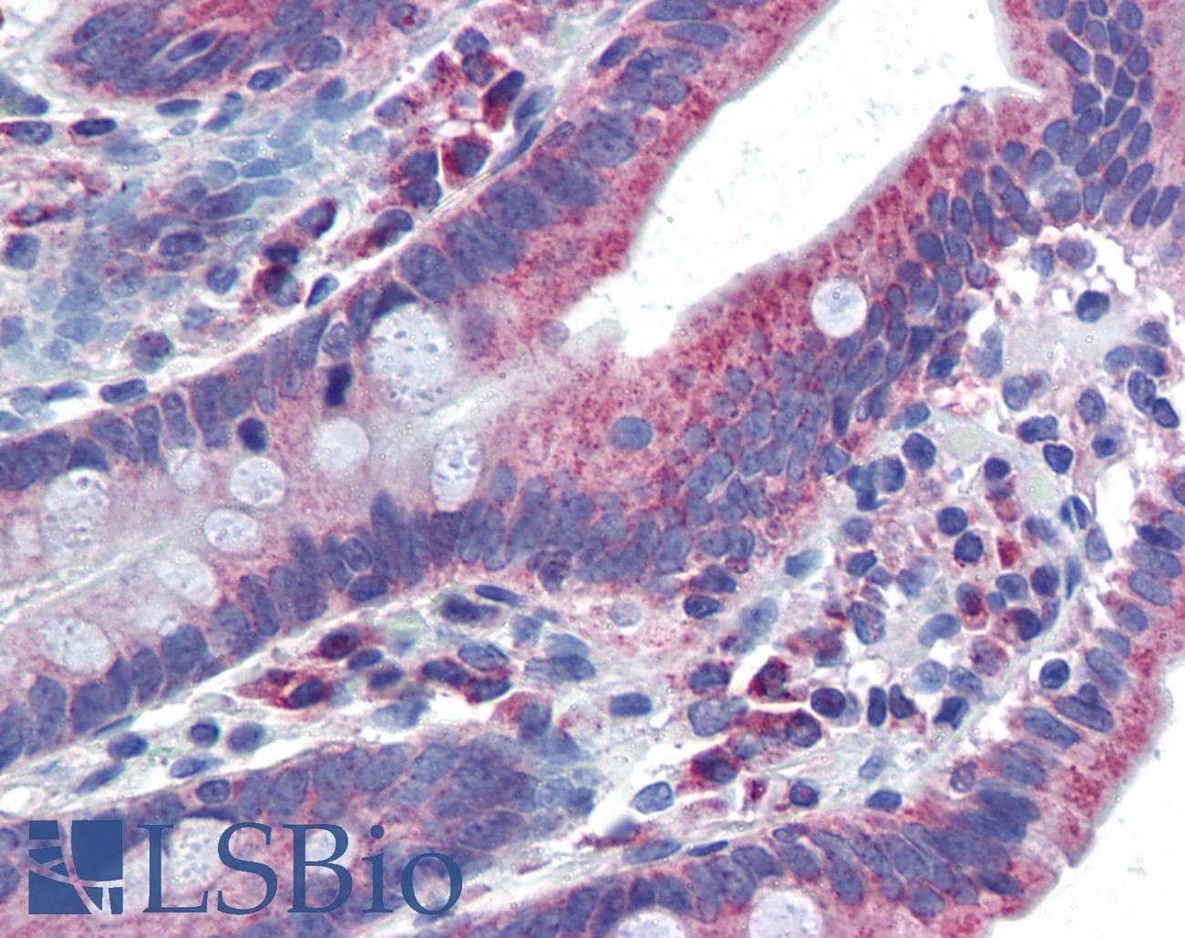 NR1I2 / PXR Antibody (aa108-157)