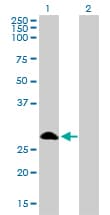 SLIM / FHL1 Antibody (clone 2A9)