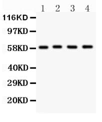 Polyclonal Rabbit anti-Human G6PD Antibody (aa315-515, WB)