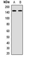 Polyclonal Rabbit anti-Human BCL9 Antibody (WB)