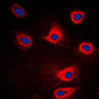 EIF2AK3 / PERK Antibody (N-Terminus)