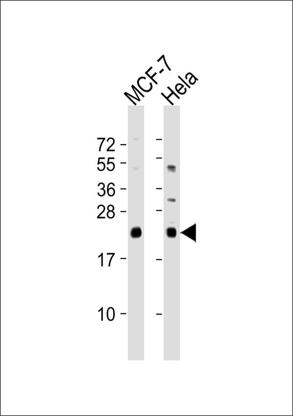NRAS / N-ras Antibody