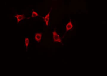 DAP-5 / EIF4G2 Antibody