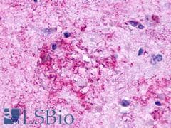 PathPlus™ GPR84 Antibody (Extracellular Domain)