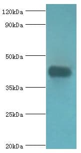 Polyclonal Rabbit anti-Human ASAH1 / Acid Ceramidase Antibody (aa146-395, IHC, WB)