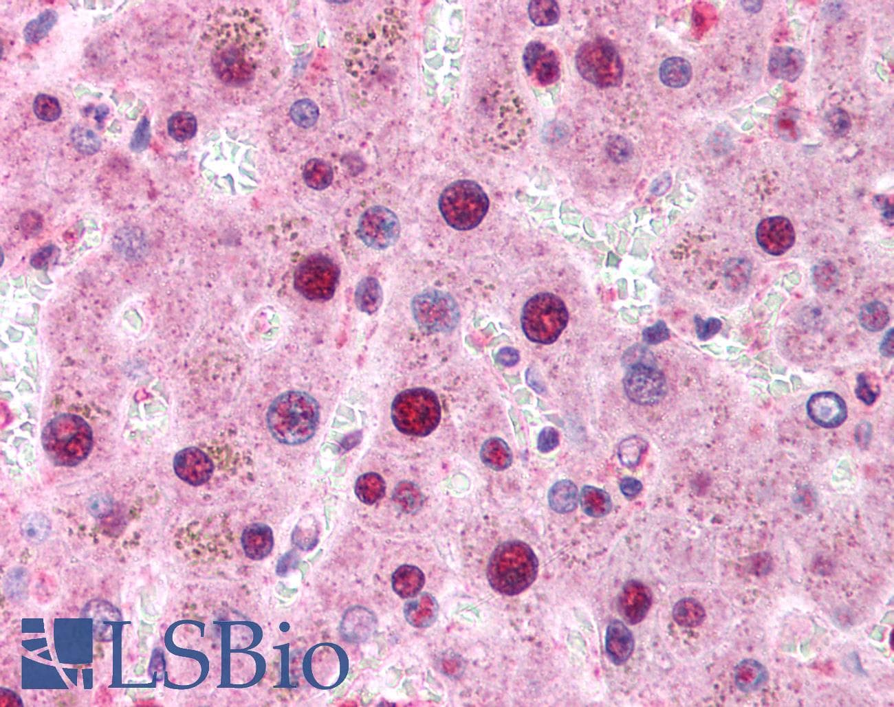 IHC-plus™ XBP1 Antibody