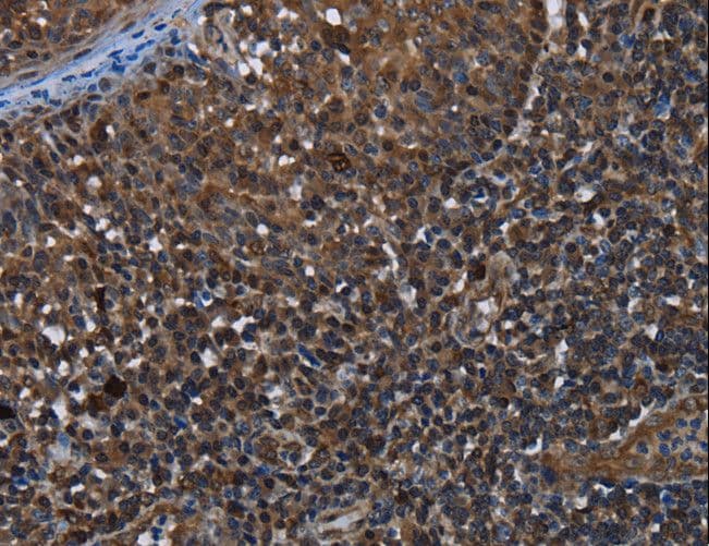 Polyclonal Rabbit anti-Human GALT Antibody (IHC, WB)
