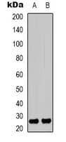IHC-plus™ Polyclonal Rabbit anti-Human HMG1 / HMGB1 Antibody (Acetyl-Lys12, IHC, WB)