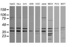 MAPK9 / JNK2 Antibody (clone OTI2D11)