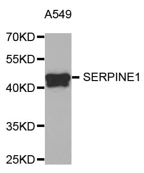 Polyclonal Rabbit anti-Human SERPINE1 / PAI-1 Antibody (IHC, WB)