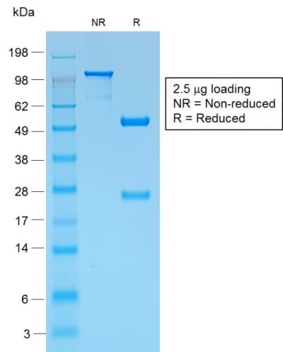 PMEL / SILV / gp100 Antibody (clone PMEL/1825R, Azide-free, Carrier-free)