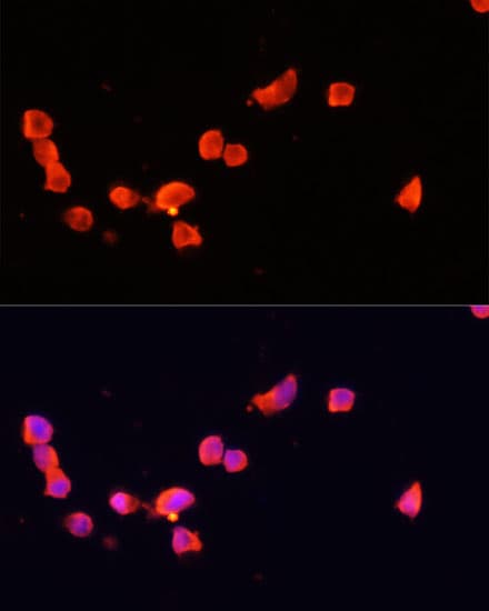 Polyclonal Rabbit anti-Human CDK5R1 Antibody (IF, WB)