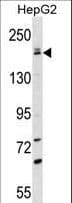 Polyclonal Rabbit anti-Human PNPLA6 / NTE Antibody (aa1000-1029, WB)