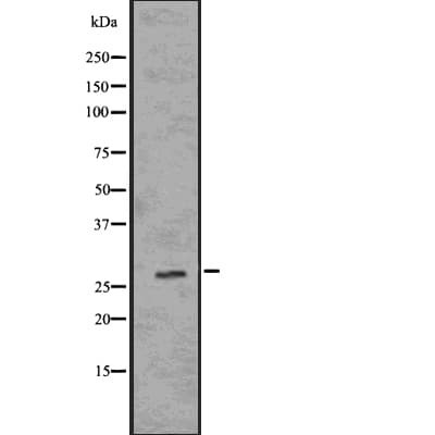 CALB2 / Calretinin Antibody