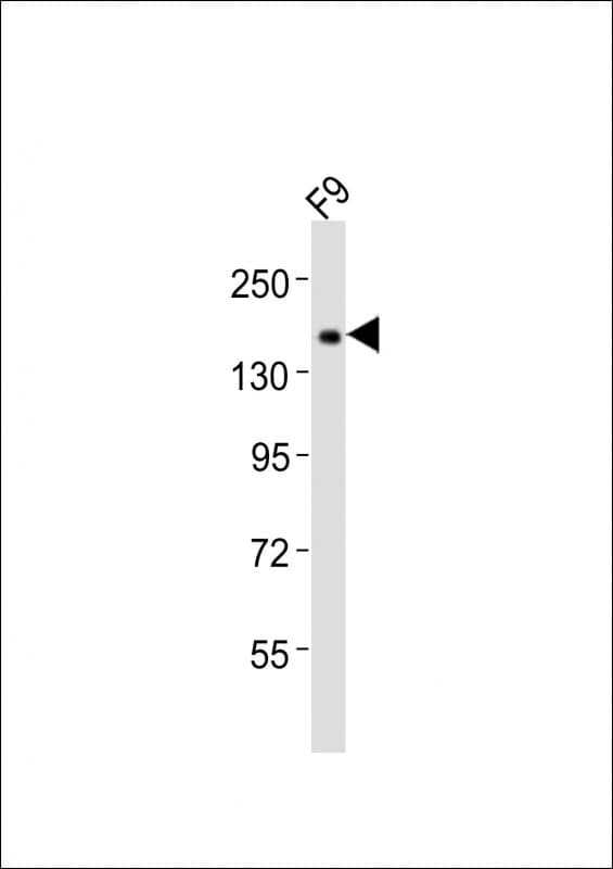 LCX / TET1 Antibody (aa1845-1879)