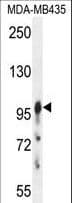 AXIN1 / Axin-1 Antibody (aa710-738)