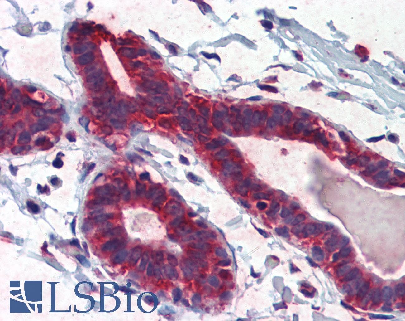 TBX5 Antibody (aa174-223)
