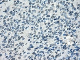 SSX2 Antibody (clone OTI4A11)